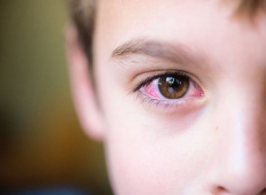 Biến chứng rất nguy hiểm của bệnh tăng huyết áp đến mắt